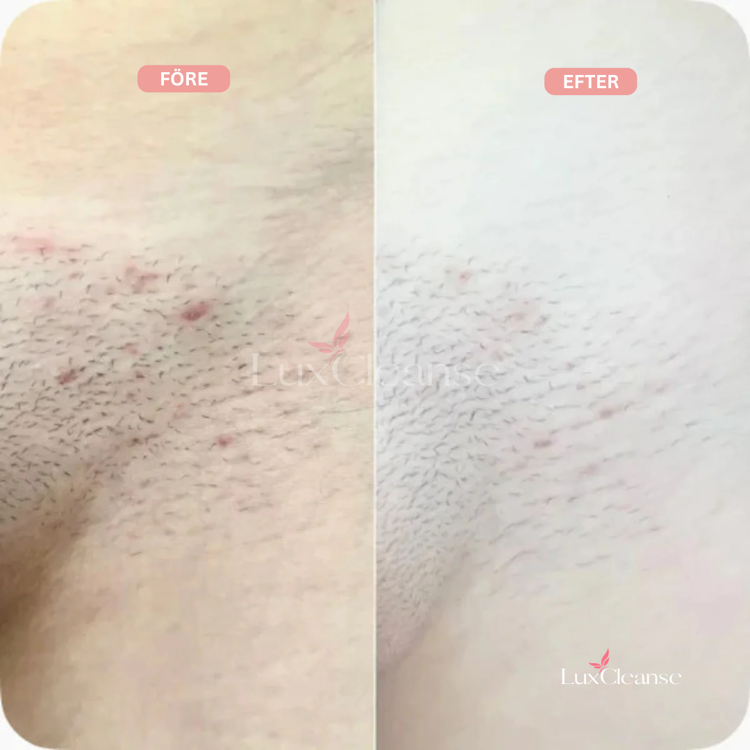 Bikini Trimmer™- För en felfri, len hud utan irritation